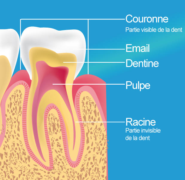 Traitement endodontique